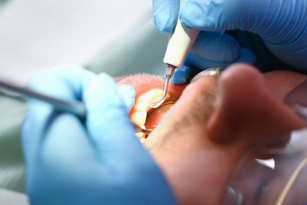Best Walk-In Emergency Dentist in Fullerton, CA
